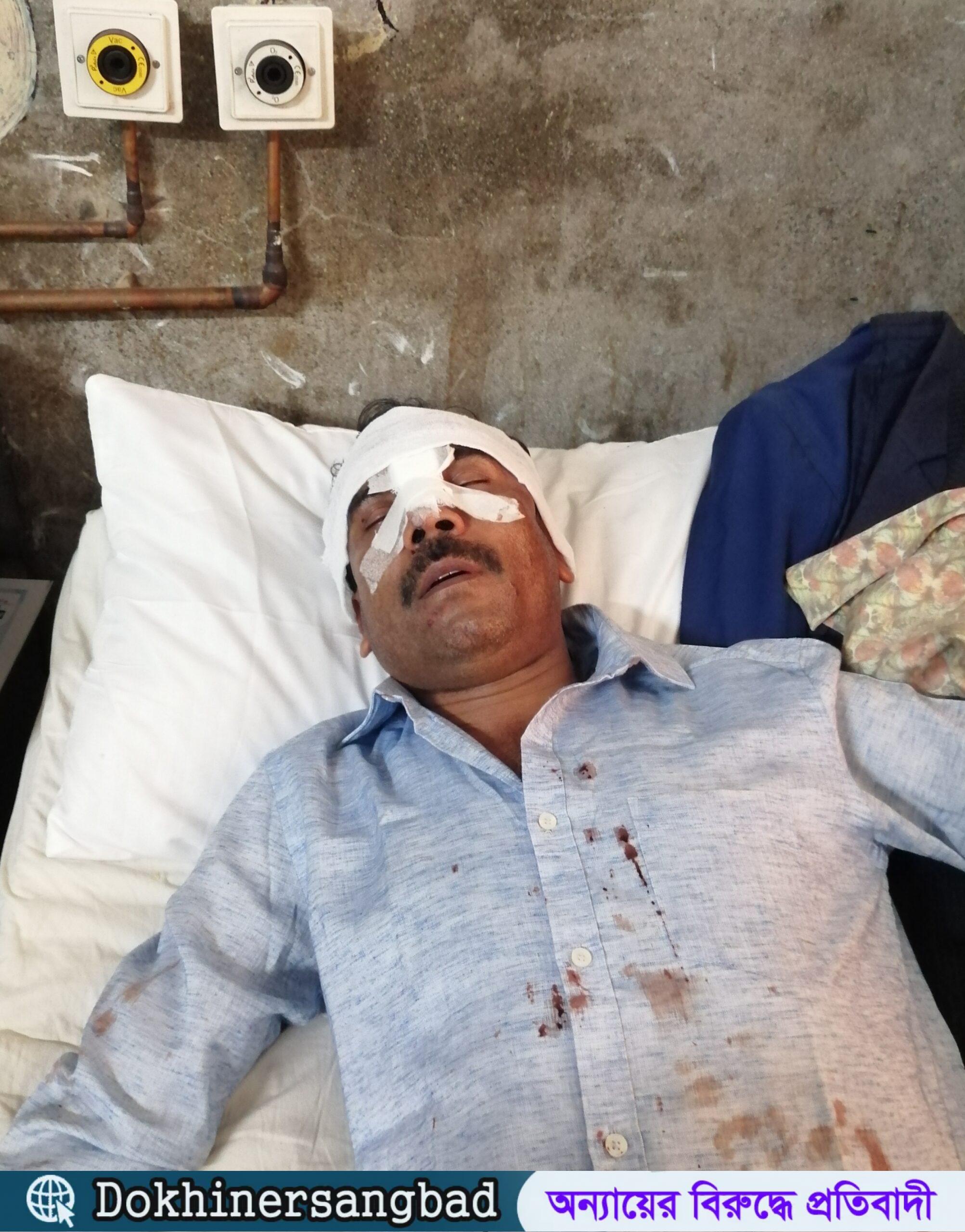 বাকেরগঞ্জে ইয়াবা সেবনে বাধা দেয়ায় ২ জনকে পিটিয়ে রক্তাক্ত জখম