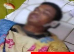 বড় ভাইয়ের কামড়ে ছোট ভাইয়ের মৃ*ত্যু