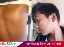 বরিশালে মোবাইল চুরির অপবাদে শিশুসহ ৩ জনকে পিটিয়ে জখম করলেন আ.লীগ নেতা
