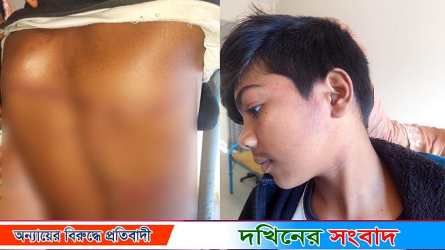 বরিশালে মোবাইল চুরির অপবাদে শিশুসহ ৩ জনকে পিটিয়ে জখম করলেন আ.লীগ নেতা