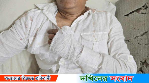 বানারীপাড়ায় চাখারে ইউপি চেয়ারম্যানের মাথা ফাঁটালেন বিএনপি-ছাত্রদল নেতা পিতা-পুত্র